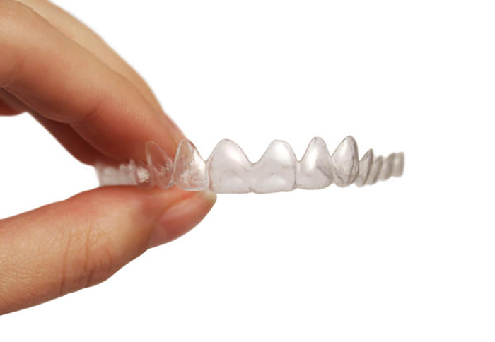 Aparelho-dental-transparente-Invisalign